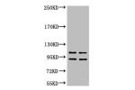 Western blot analysis of 1) Hela, 2) HepG2, diluted at 1:2000