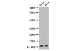 Western blot analysis of Hela, diluted at  1) 1:1000  2) 1:5000