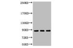 Western blot analysis of 1) Hela, 2) Jurkat, 3) HepG2, diluted at 1:2000
