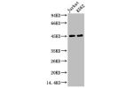 Western blot analysis of 1) Jurkat, 2) K562, diluted at 1:2000.
