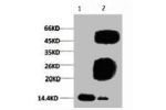 Western blot analysis of Hela, diluted at 1:500.