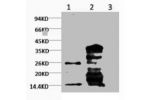 Western blot analysis of Hela, diluted at  1) 1:1000  2) 1:3000
