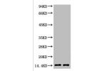 Western blot analysis of Hela, diluted at  1) 1:2000  2) 1:5000