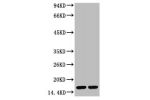 Western blot analysis of Hela, diluted at  1) 1:2,000 2) 1:5,000