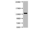 Western blot analysis of Hela, diluted at 1:1000.