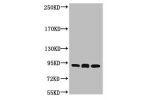 Western blot analysis of 1) Hela, 2) Mouse Brain tissue, 3) Rat Brain tissue, diluted at 1:2000.