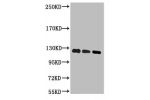 Western blot analysis of 1) Hela, 2) 293T, 3) Jurkat, diluted at 1:2000.