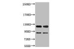 Western blot analysis of 1) Jurkat, 2) Hela, diluted at 1:2000.