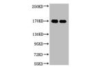 Western blot analysis of 1) A431, 2) Hela, diluted at 1:2000.
