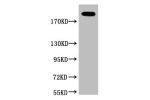 Western blot analysis of Hela, diluted at 1:2000.