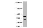 Western blot analysis of Jurkat, diluted at 1:3000.