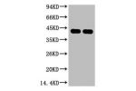 Western blot analysis of Arabidopsis, diluted at 1) 1:5000  2) 1:10000