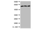 Western blot analysis of 1) Hela, 2) Mouse Brain Tissue, 3) Rat Brain tissue, diluted at 1:2000.