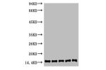 Western blot analysis of 1) Hela, 2) 3T3, 3) Raw264.7, 4) Rat Brain, 5) Rat Kidney, diluted at 1:2000.