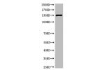 Western blot analysis of Rat Heart Tissue, diluted at 1:1000.