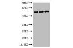 Western blot analysis of 1) Hela, 2) Mouse Brain, 3) Rat Brain, diluted at 1:5000.