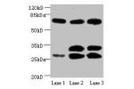 Western blot<br />
All lanes :Amyloid beta A4 antibody at 1