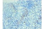 Immunohistochemical of paraffin-embedded human spleen tissue using CSB-MA002401E0m at dilution of 1:200