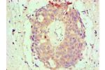 Immunohistochemical of paraffin-embedded Human endometrium tissue using CSB-MA0026131A0m at dilution of 1:200