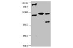 All lanes:Mouse anti-human ENO2 monoclonal antibody at 1ug/ml<br />
Lane 1:Hela cell lysate<br />
Lane 2:Recombinant Human Gamma-enolase(ENO2) at 10ug<br />
Lane 3:U251 cell lysate<br />
Secondary Goat polyclonal to Mouse IgG at 1/3000 dilution<br />
Pred