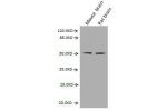 Western Blot <br />
Positive WB detected in:Mouse brain tissue,Rat brain tissue<br />
All lanes :GFAP antibody at 2.7ug/ml<br />
Predicted band size: 50,51 kDa <br />
Observed band size: 50 kDa <br />