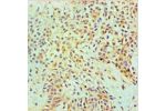 Immunohistochemical of paraffin-embedded Human Breast tissue using CSB-MA0106441A0m at dilution of 1:200.