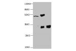 All lanes:Mouse anti-Human Cyfra21-1(KS19.1) monoclonal antibody at 4ug/ml<br />
Lane 1: MCF7 cell lysate<br />
Lane2: MDA-MB-231 cell lysate<br />
Lane3: HepG-2 cell lysate<br />
Secondary HRP labeled Goat polyclonal to Mouse IgG at 1/3000 dilution<br />