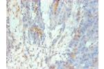 Immunohistochemical of paraffin-embedded human Ovarian tissue using CSB-MA0128871A0m at dilution of 1:200