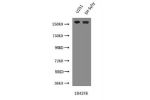 Western Blot <br />
Positive WB detected in:U251 whole cell lysate,SH-Sy5y whole cell lysate <br />
All lanes :NES antibody at 3 ug/ml<br />
Predicted band size: 260 kDa <br />
Observed band size: 260 kDa <br />