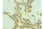 Immunohistochemical of paraffin-embedded human lung tissue using CSB-MA0206421A0m at dilution of 1:200