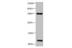 All lanes:Mouse anti-Human Timp1 monoclonal antibody at 1ug/ml<br />
Lane 1: HepG-2 cell lysate<br />
Predicted band size : 23 kDa<br />
Observed band size : 23 kDa<br />
Additional bands at:50KD<br />