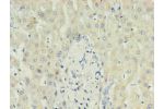 Immunohistochemistry of paraffin-embedded human liver using CSB-MA027411E0m in 30ug/ml dilute concentrations.
