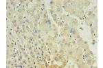 Immunohistochemistry of paraffin-embedded human liver using CSB-MA027711A0m in 30ug/ml dilute concentrations.