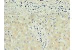 Immunohistochemistry of paraffin-embedded human liver using CSB-MA027711E0m in 30ug/ml dilute concentrations.