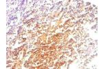 Immunohistochemical of paraffin-embedded human Tonsil tissue using CSB-MA057861A0m at dilution of 1:200