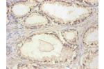 Immunohistochemical of paraffin-embedded human prostate tissue using CSB-MA061901A0m at dilution of 1:200