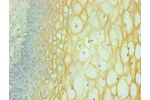 Immunohistochemical of paraffin-embedded human cervical using CSB-MA065241A0m at dilution of 1:200
