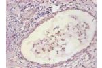 Immunohistochemical of paraffin-embedded human prostate tissue using CSB-MA067571A0m at dilution of 1:200