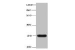 All lanes:Mouse anti-human Neutrophil gelatinase-associated lipocalin monoclonal antibody at 1ug/ml<br />
Lane 1:NGAL transfected 293 cell lysate<br />
Predicted band size : 22 kDa<br />
Observed band size : 25 kDa<br />