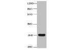 All lanes:Mouse anti-human Neutrophil gelatinase-associated lipocalin monoclonal antibody at 1ug/ml<br />
Lane 1:NGAL transfected 293 cell lysate<br />
Predicted band size : 22 kDa<br />
Observed band size : 25 kDa<br />