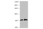 All lanes: Mouse anti- human Retinol-binding protein 4 monoclonal antibody at 0.3ug/ml<br />
Lane 1: Human positive serum1:10<br />
Lane 2: Human positive serum1:100<br />
Secondary:HRP labeled Goat polyclonal to Mouse IgG at 1/3000 dilution<br />
Predict