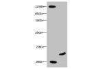 All lanes:Mouse anti-Human Myoglobin monoclonal antibody at 0.3ug/ml<br />
Lane 1:mouse heart muscle lysate<br />
Lane 2:Recombinant Myoglobin at 10ug<br />
Secondary:HRP labeled Goat polyclonal to Mouse IgG at 1/3000 dilution<br />
Predicted band size : 