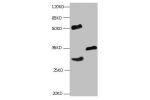 All lanes: Mouse monoclonal to Human Cardiac Troponin I at 1ug/ml<br />
Lane 1:rat heart muscle lysate<br />
Lane2:mouse heart muscle lysate<br />
Lane3:CTnI transfected SF9 cell lysate<br />
Predicted band size : 23kd<br />
Observed band size : 30kd<br /