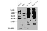Western blot analysis of 1) Jurkat, 2) 293T, 3) Rat Brain Tissue, 4) Mouse Brain Tissue with Phosphotyrosine Mouse mAb diluted at 1:2,000.