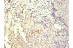 Immunohistochemical of paraffin-embedded human tonsil tissue using CSB-MA083271A0m at dilution of 1:200.