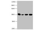 All lanes: Mouse anti- Human Insulin-like growth factor-binding protein 1 monoclonal antibody at 1ug/ml<br />
Lane 1:Pyrolysis liquid human placental tissue 7.5ug/ml<br />
Lane 2:Pyrolysis liquid human placental tissue 3.25ug/ml<br />
Lane 3:IGFBP1 transf