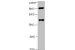 All lanes: Mouse anti-human Platelet-activating factor acetylhydrolase monoclonal Antibody at 1ug/ml<br />
Lane 1:mouse spleen tissue<br />
Secondary:HRP labeled Goat polyclonal to Mouse IgG at 1/3000 dilution<br />
Predicted band size : 48kd<br />
Observ