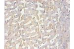 Immunohistochemical of paraffin-embedded human liver tissue using CSB-MA100091A0m at dilution of 1:200