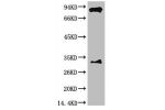 Western blot analysis of Mouse Brain Tissue with HIF-1 