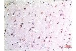 Immunohistochemical analysis of paraffin-embedded Human Brain Tissue using Beclin-1 Mouse mAb diluted at 1:200.